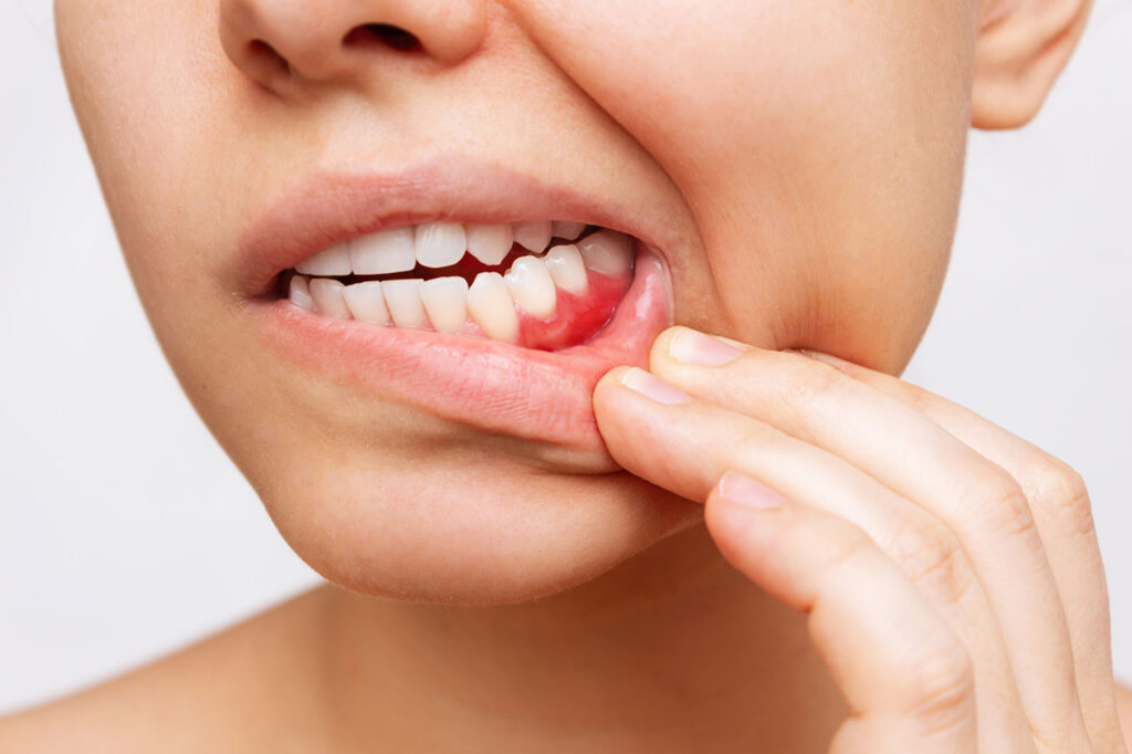 Periodontal Therapy in Chicago: Why Healthy Gums Matter More Than You Think