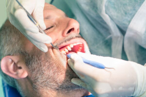 Dental Bonding in Chicago: What Can It Fix and How Long Does It Last?